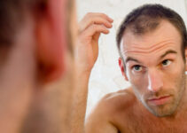 Top 6 Reasons for Hair loss in Men and How to Avoid Them